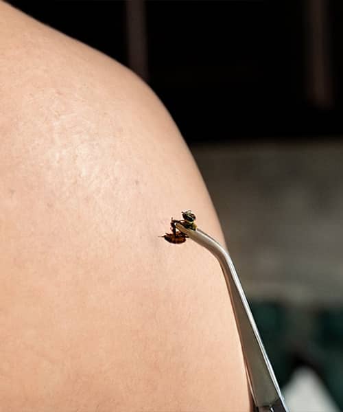 Apiterapeuta Profesional: Terapias con Veneno de Abeja y Productos Apícolas