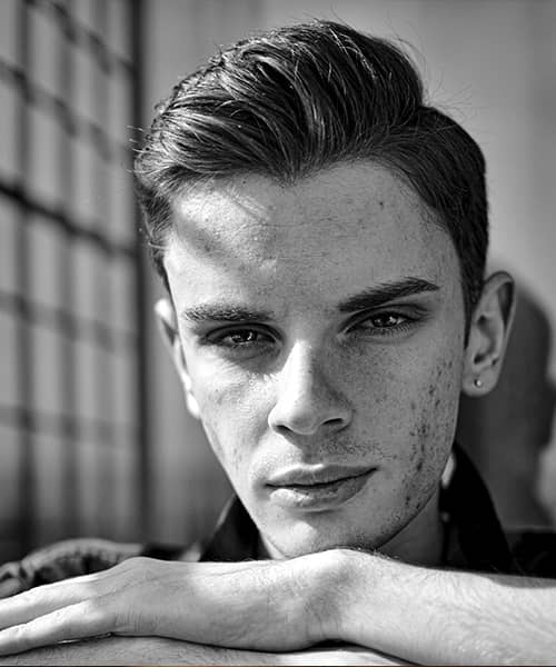 Acné: origen y soluciones naturales