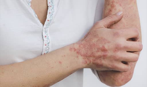 Tratamientos para solucionar problemas en la piel desde dentro