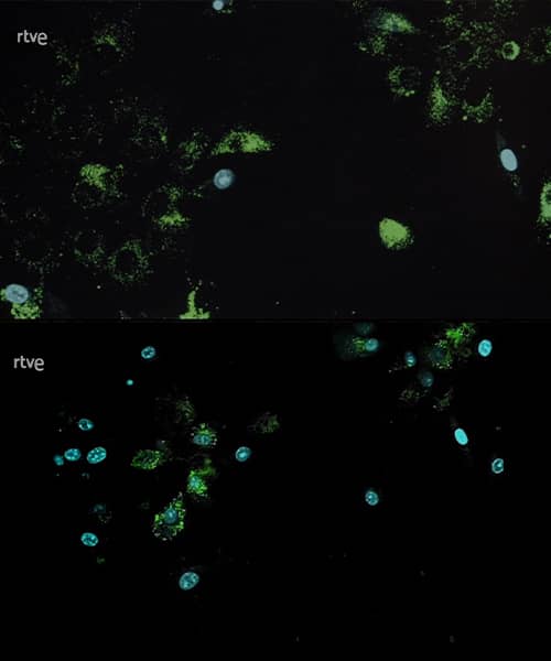 Efecto del veneno de abeja en glóbulos rojos durante la primera exposición