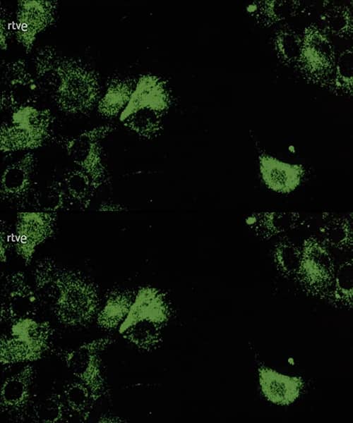 Células protegidas tras una segunda exposición al veneno de abeja